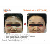 PURISMA - Plasma Skin Rejuvenation Therapy